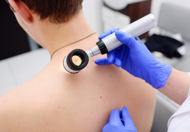 Um médico examina as costas de um homem com uma lupa.