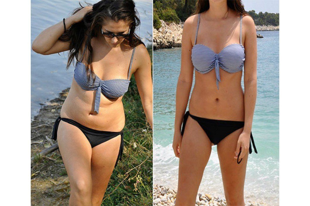 before and after weight loss