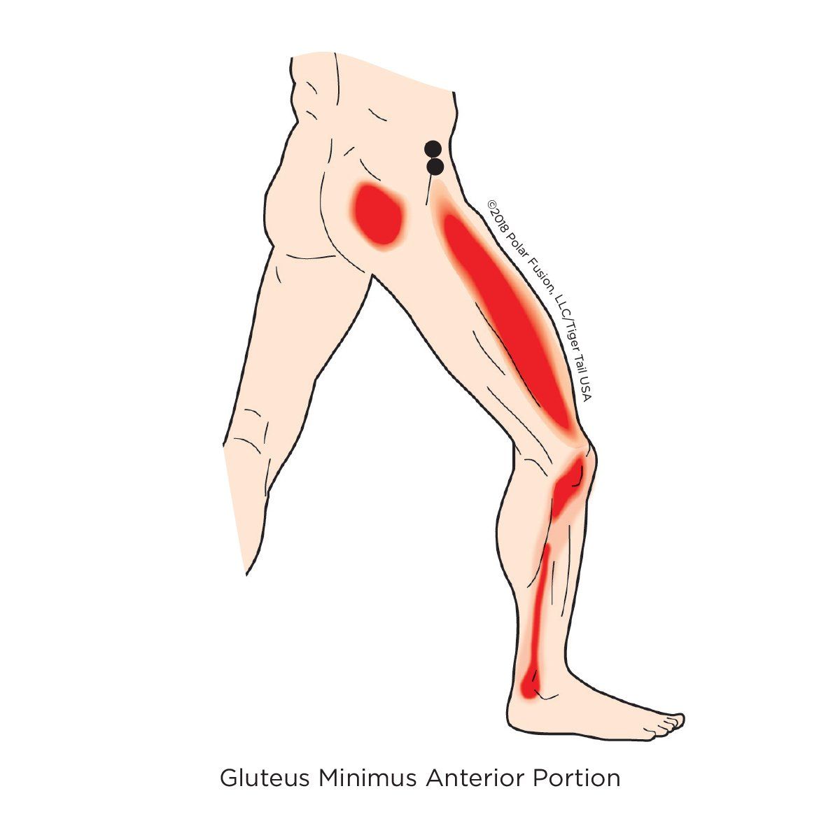 A diagram showing the location of the gluteus minimus anterior portion