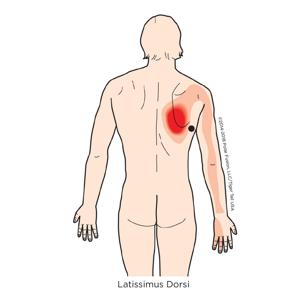 A drawing of a man 's back with a red spot on it
