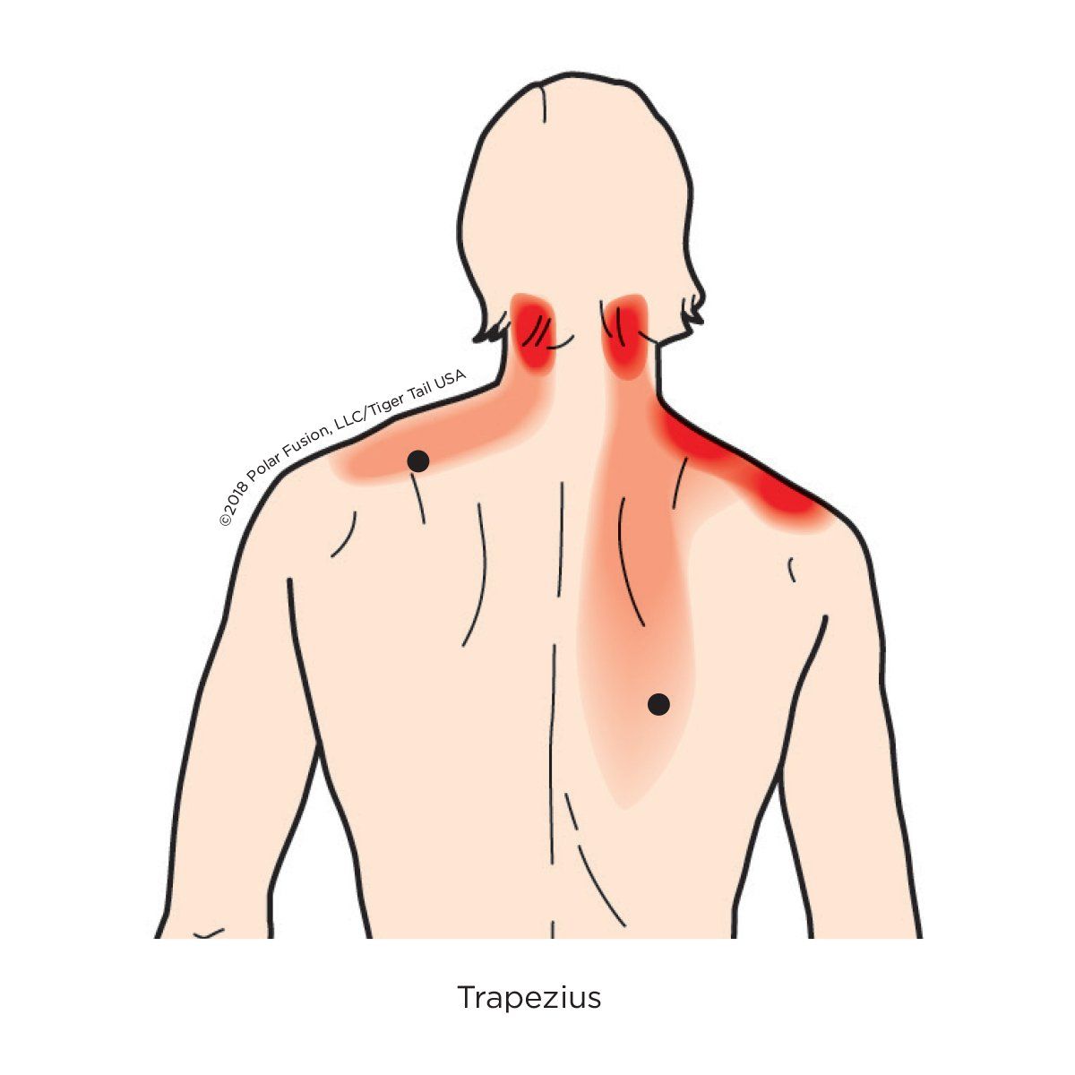 A drawing of a man 's back with red spots on it