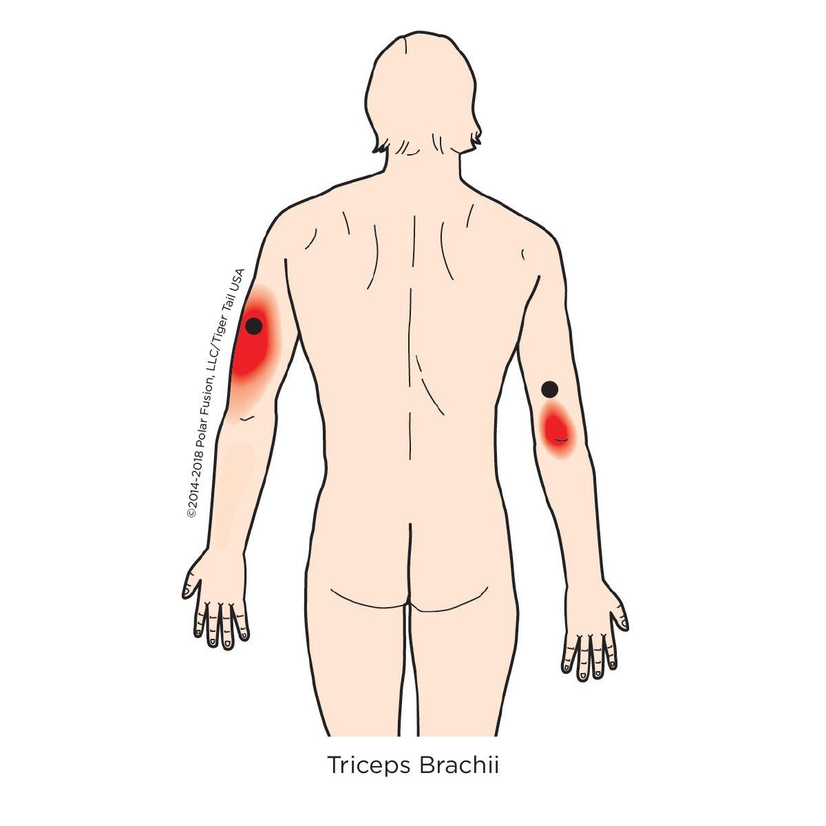A drawing of a man 's back showing the location of the triceps brachii muscle.