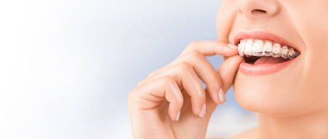 apparecchio per denti