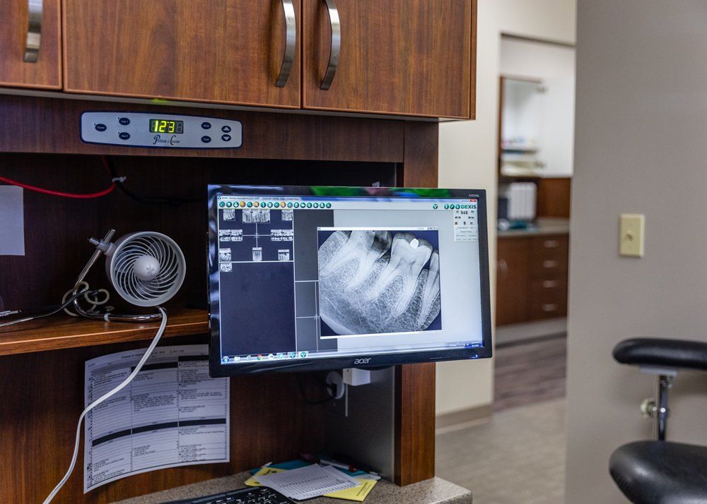 Root Canal Dentist — Mouth X-Ray in Jasper, IN