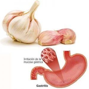 Beneficios del Ajo