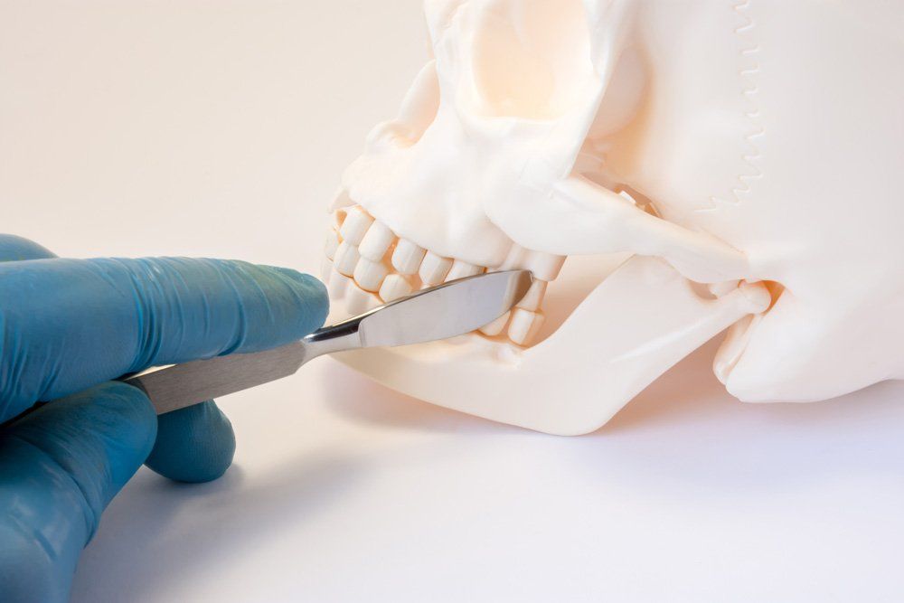 Maxillofacial Surgery — Sandusky, Ohio — North Coast Oral & Maxillofacial Surgery Maxillofacial Surgery — Sandusky, Ohio — North Coast Oral & Maxillofacial Surgery