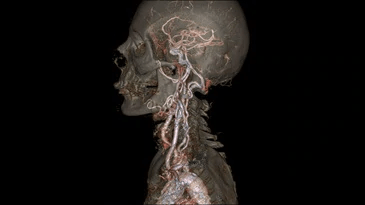 A computer-generated image of a heart with roots on a black background.
