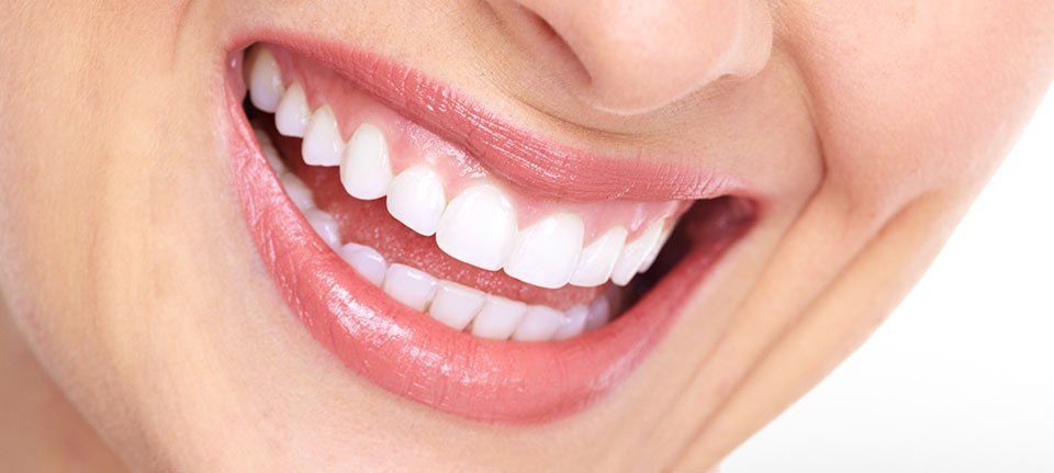 Close view of a lady's smiling mouth with white teeth
