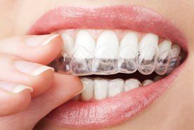 A home whitening kit
