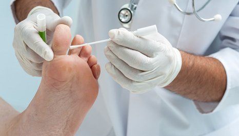 verruca treatment