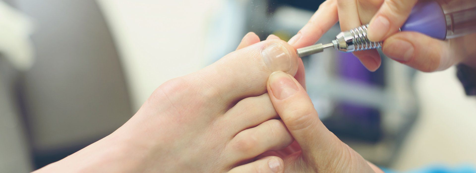 toenail treatment