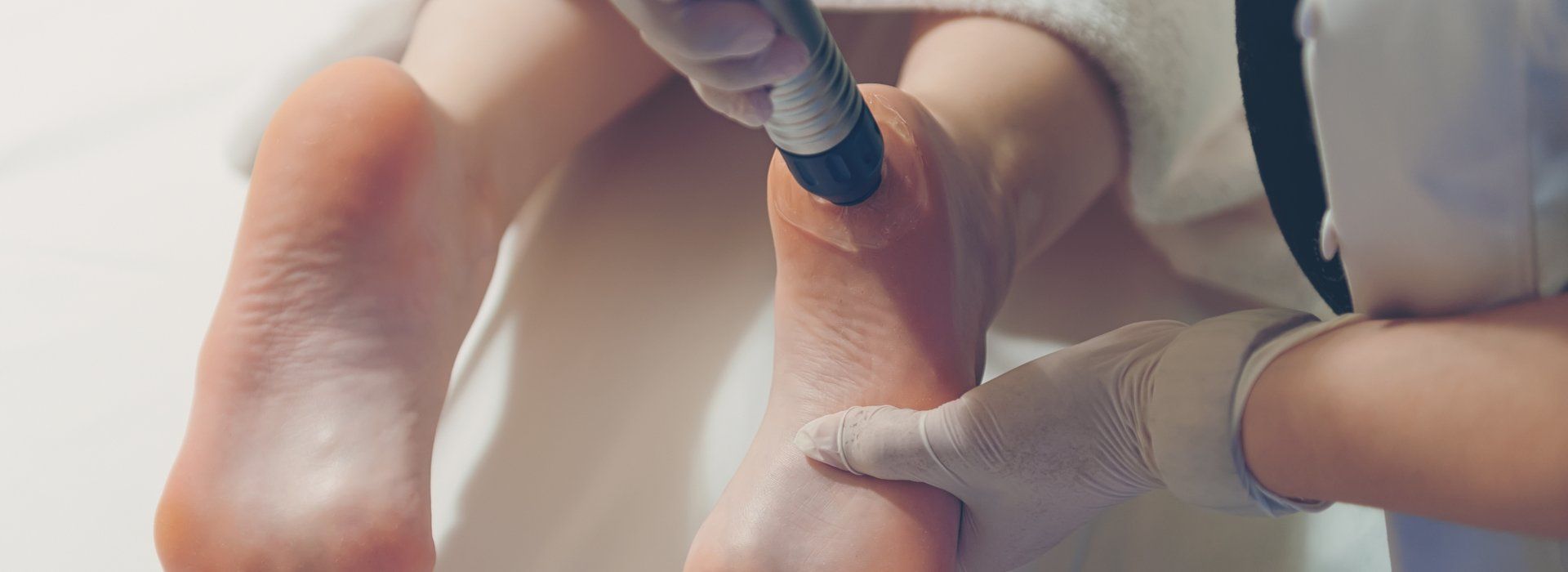 callus treatment