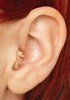 In The Canal Hearing Aid — Gainesville, FL — Gainesville Hearing Aid Center In The Canal Hearing Aid — Gainesville, FL — Gainesville Hearing Aid Center