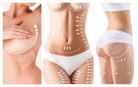 Plastic Surgeons Need Sharps Terminator® Plastic Surgeons Need Sharps Terminator®