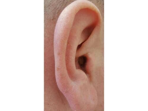 Hearing Clinic — Right Ear in Bend, OR