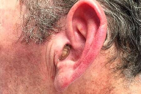 New Hearing Aid — Left Ear with Hearing Aid in Bend, OR New Hearing Aid — Left Ear with Hearing Aid in Bend, OR