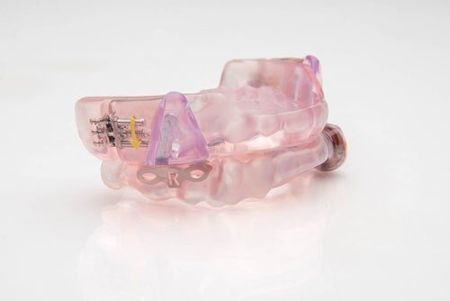 Fusion alone — Dentures in Virginia Beach, VA Fusion alone — Dentures in Virginia Beach, VA