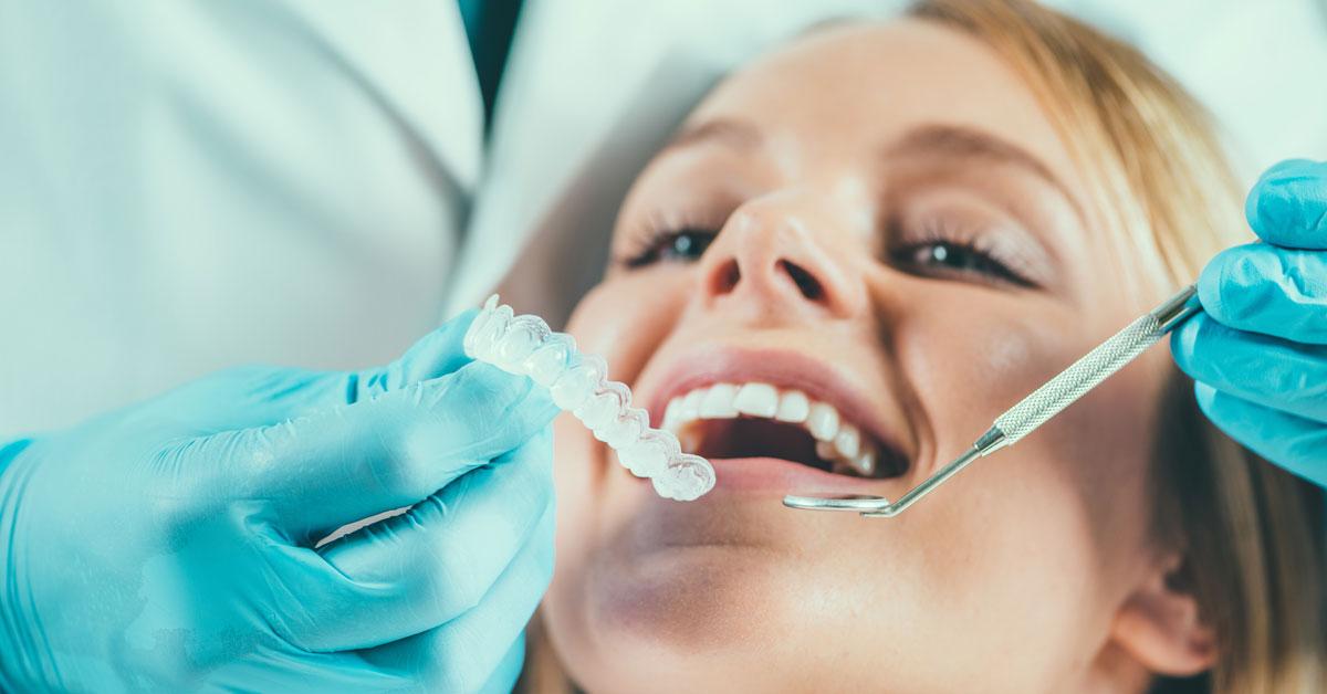 DENTAL IMPLANTS