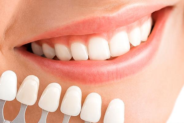 teeth whitening brooklyn