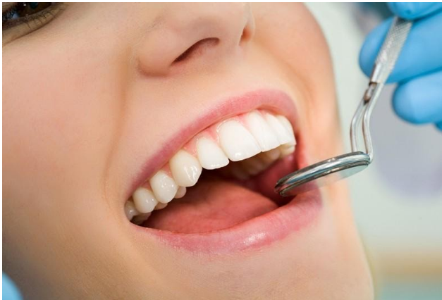 DENTAL IMPLANTS