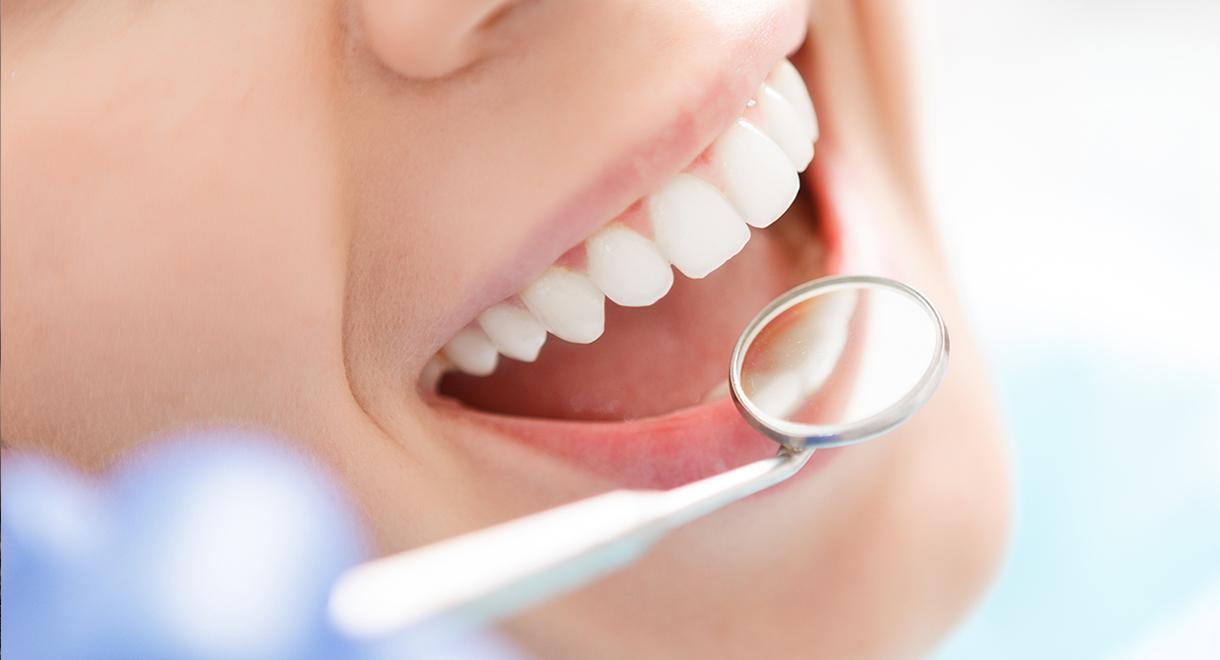DENTAL IMPLANTS