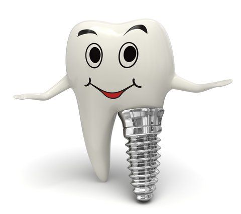 DENTAL IMPLANTS