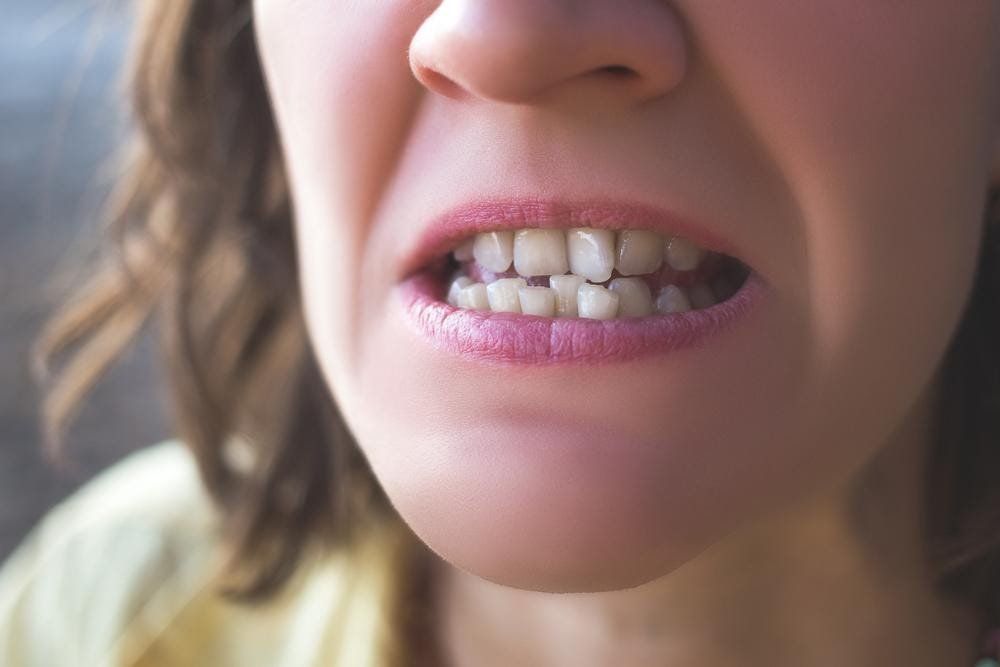 teeth whitening brooklyn
