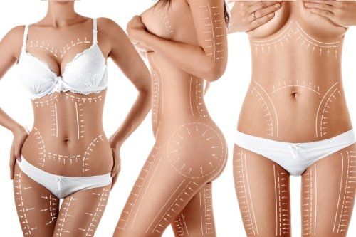 chirurgia plastica a Venezia per riduzione adipe