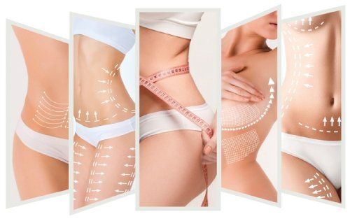 interventi di chirurgia plastica a Venezia per adipe localizzato