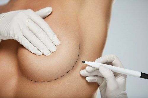 intervento di chirurgia plastica a Venezia per aumento seno