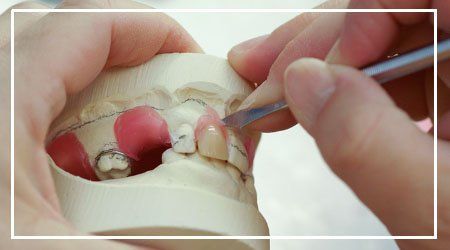 Making Dentures — denture repairs in Fredericksburg, VA Making Dentures — denture repairs in Fredericksburg, VA