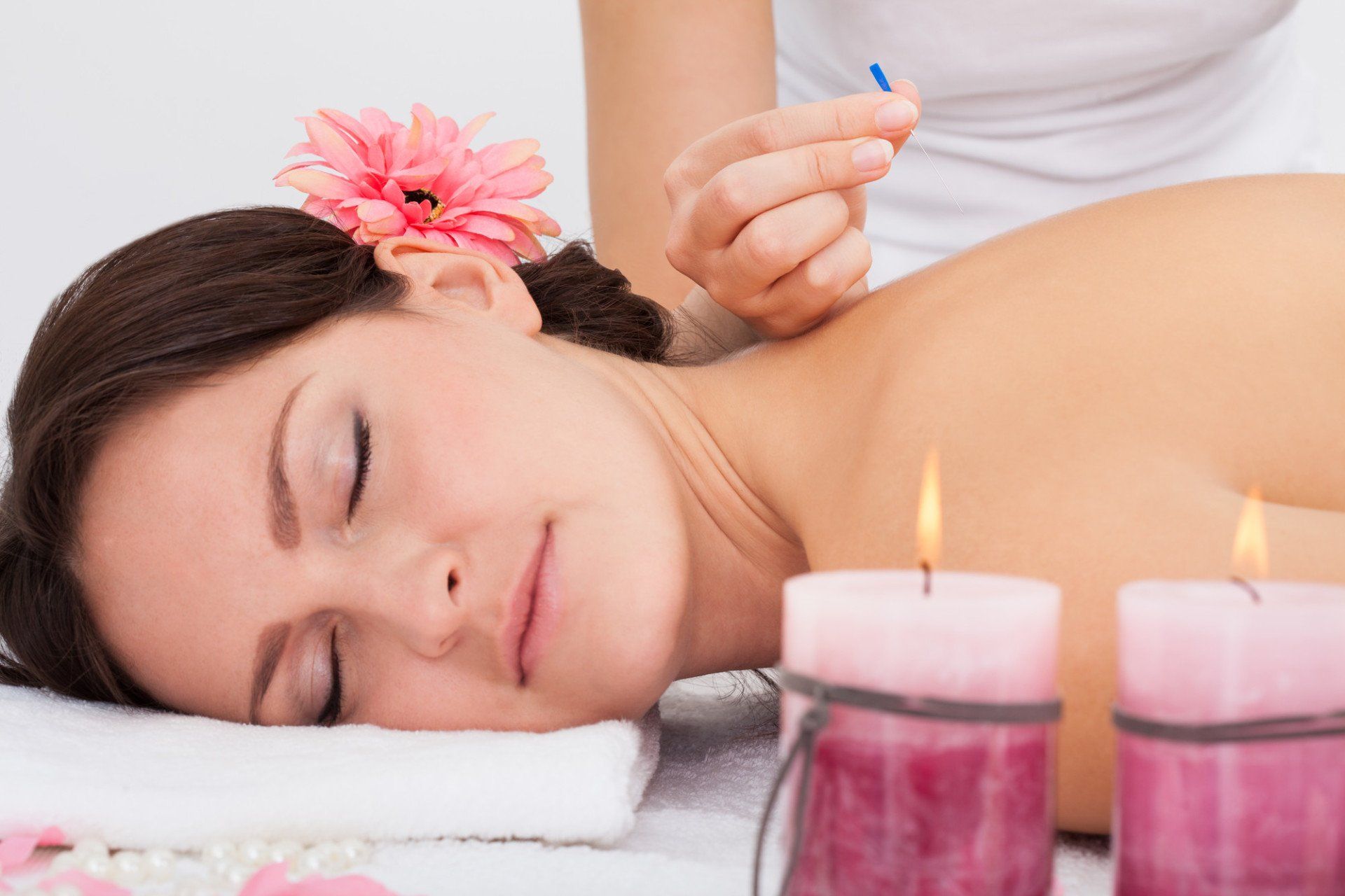 Acupuncture treatment