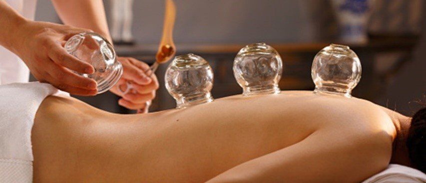 cupping treatment