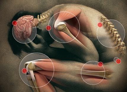 Pain Management