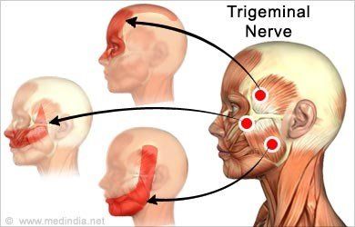 head pain sites