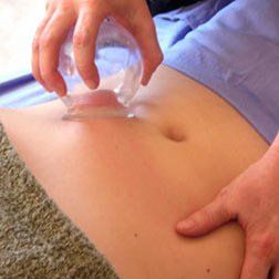 cupping therapy in wimbledon at health zone clinic