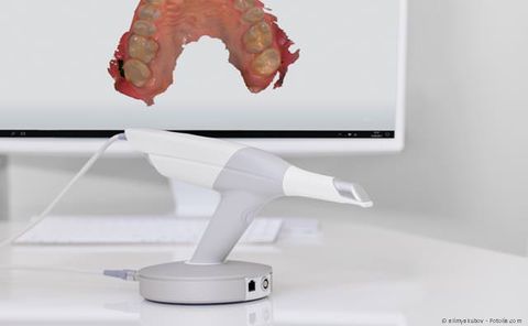 Intraoraler 3D-Scanner statt Abformungen Intraoraler 3D-Scanner statt Abformungen