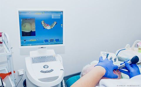 Cerec: Digitale Aufnahme und Herstellung von Keramik-Inlays, Kronen und Brücken Cerec: Digitale Aufnahme und Herstellung von Keramik-Inlays, Kronen und Brücken