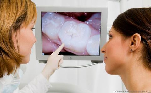 Intraorale Kamera: Vergrößerter Blick in den Mund Intraorale Kamera: Vergrößerter Blick in den Mund