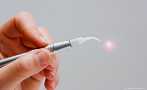 Laser in der Zahnmedizin: Schonende und schmerzarme Behandlung ohne Blutungen Laser in der Zahnmedizin: Schonende und schmerzarme Behandlung ohne Blutungen