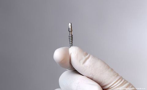 Minimalinvasive Implantation: Besonders schonend und ohne Skalpell und Nadel Minimalinvasive Implantation: Besonders schonend und ohne Skalpell und Nadel