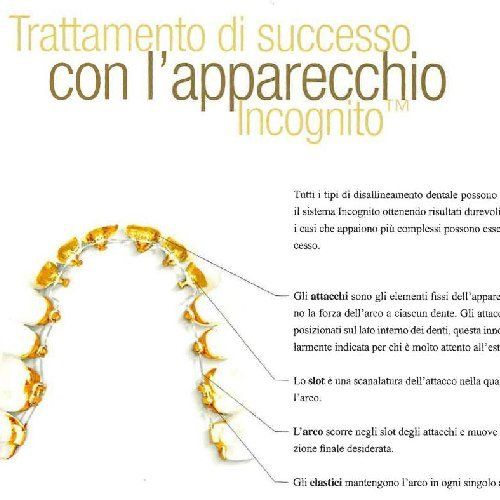 Foglio illustrativo apparecchio dentale Incognito