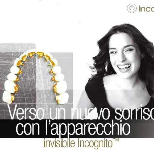 pubblicità apparecchio invisibile Incognito