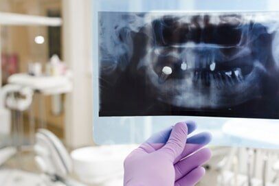 Hand Holding X-ray Result — Burnsville, MN — Centerpointe Dental Hand Holding X-ray Result — Burnsville, MN — Centerpointe Dental