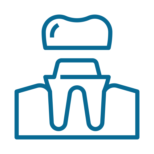 Best Family Dentist for Dental Crowns in Temecula CA 92592 Dental Crowns Icon | Top Family Dentist in Houston TX 92592