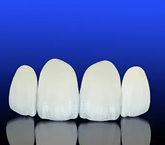 Dental Sealants in Athens - TLC Dental Wellness