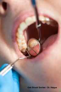 Dental examination: a mouth with teeth, mirror and probe visible.
