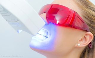 Power-Bleaching: Lichtaktivierung Power-Bleaching: Lichtaktivierung