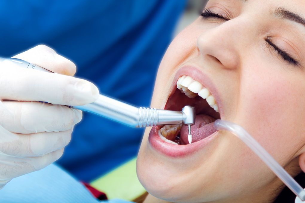 Controllo dentale