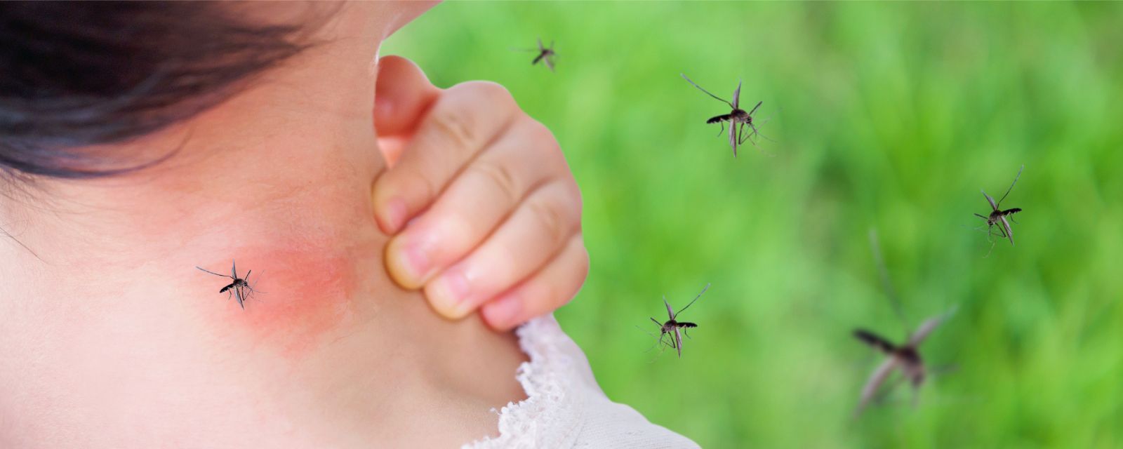 Tips for Mosquito Control in Homes Near Lexington, Kentucky (KY) like Contacting Pest Professionals
